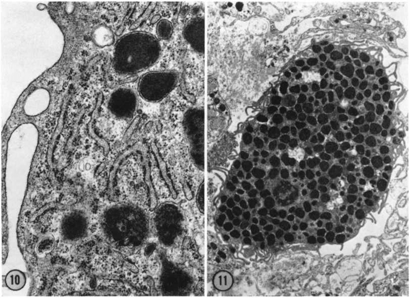 This is an electron microscopy figure of a mast cell, a type of immune cell. The cell contains many granules which have toxic mediators that can fight germs.